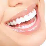 Hollywood Smile Medellín