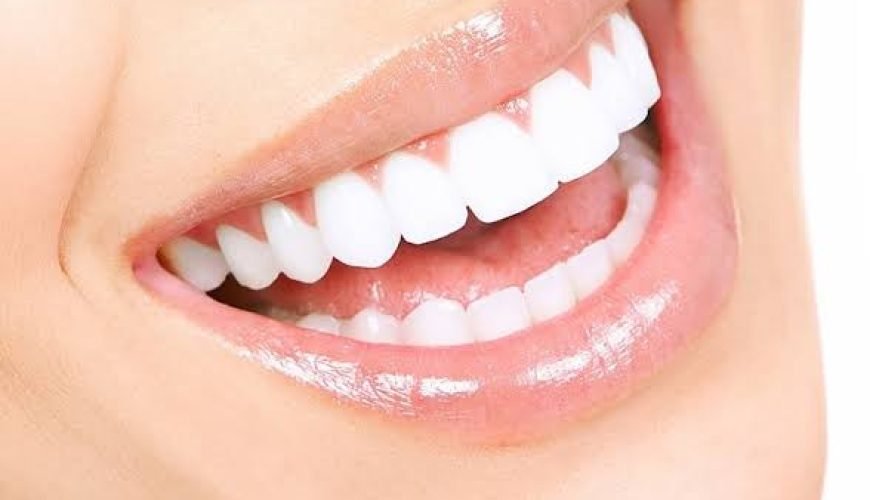 Hollywood Smile Medellín