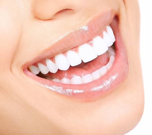 Hollywood Smile Medellín