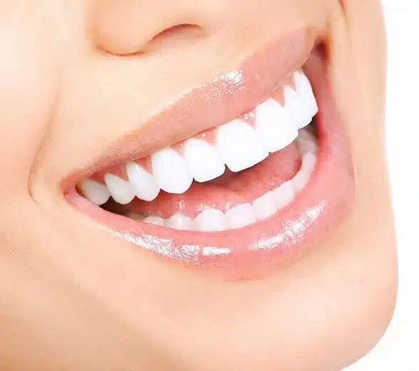 Hollywood Smile Medellín